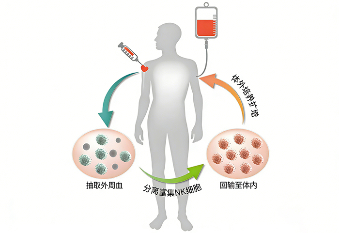 生成自体 NK 细胞回输流程图.jpg